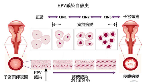 子宫颈细胞检查