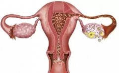 子宫内膜厚度多少才容易受孕呢?