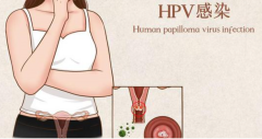 感染了HPV还可以怀孕吗,会不会感染到孩子?